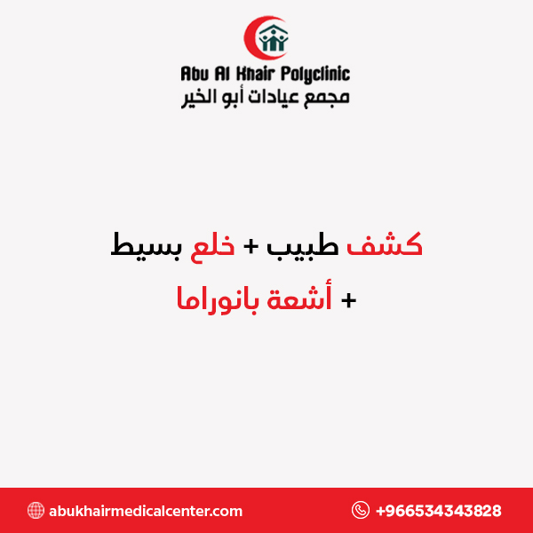 كشف طبيب + خلع بسيط + أشعة بانوراما service