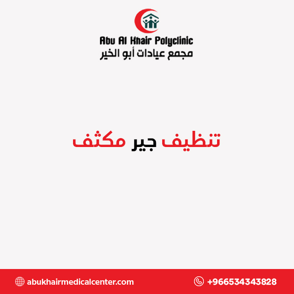 تنظيف جير مكثف service