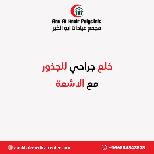 خلع جراحي للجذور مع الاشعة service