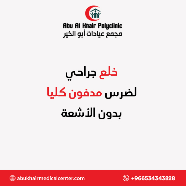 خلع جراحي لضرس مدفون كليا بدون الأشعة service