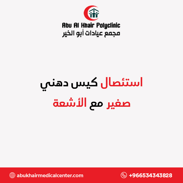 استئصال كيس دهني صغير مع الأشعة service