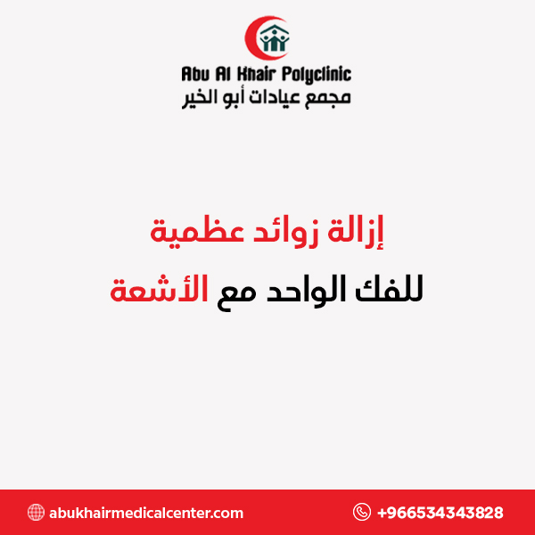 إزالة زوائد عظمية للفك الواحد مع الأشعة service
